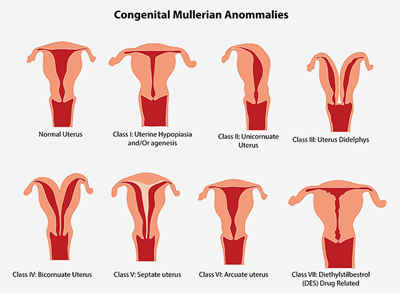 uterine abnormalities